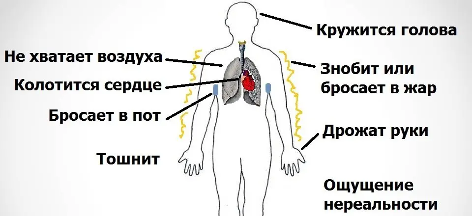 Симптомы панической атаки Симптомы панической атаки